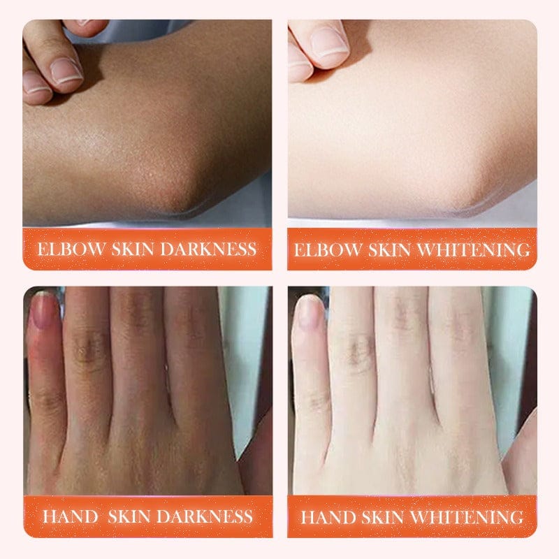 SADOER Dark Knuckle Whitening Niacinamide+Vitamin C Serum-50ml