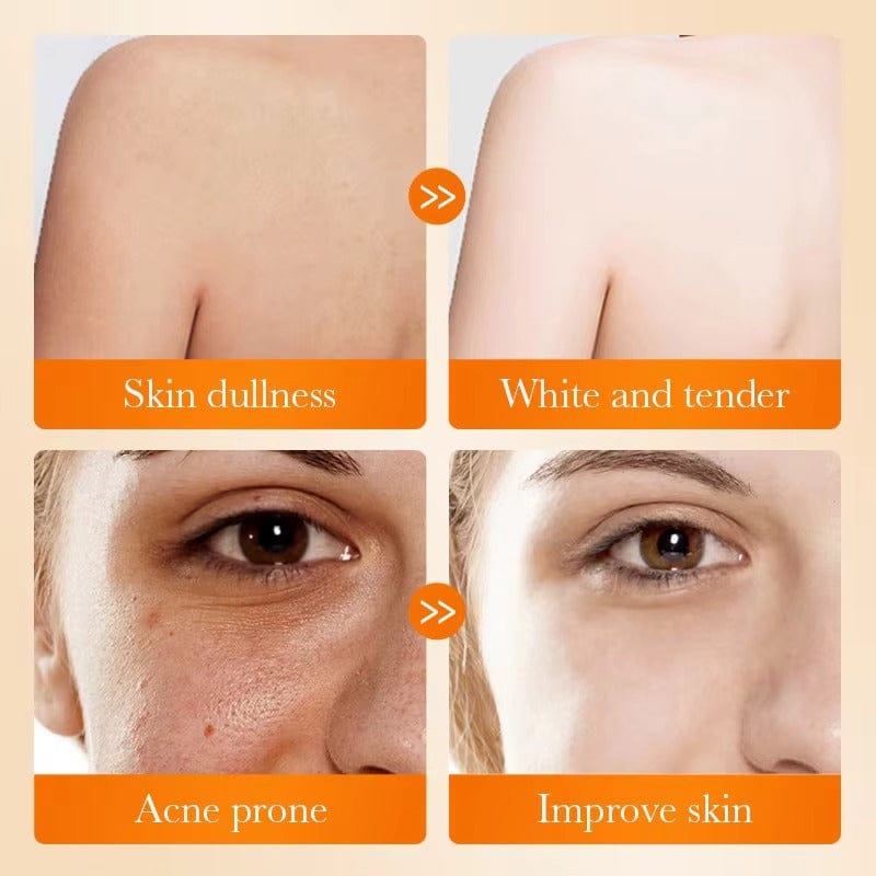 SADOER KOJIC ACID WHITENING SOAP